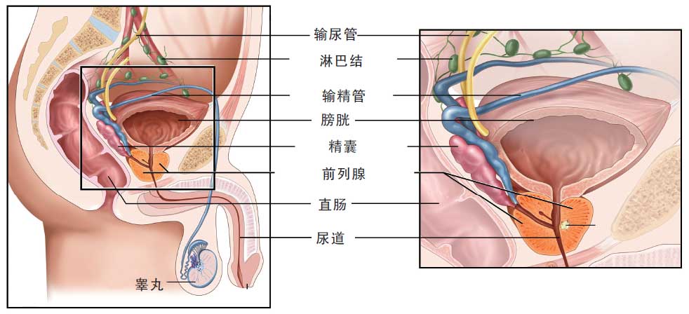 哪些男性容易患上前列腺痛呢