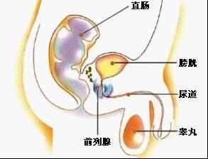 前列腺痛是哪些生活习惯导致的