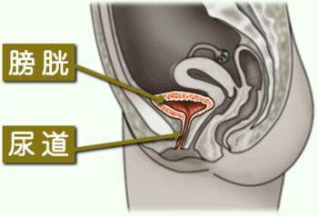 急性膀胱炎该如何诊断