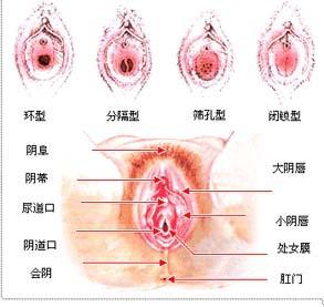 处女膜示意图