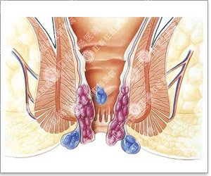 苏州哪家医院看痔疮好?
