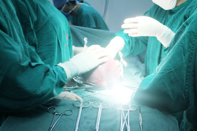 巨型肌瘤被取出的瞬间