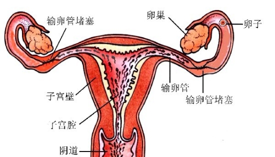 苏州子宫腔粘连医院