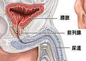苏州前列腺治疗医院