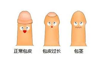 苏州治疗包皮过长医院