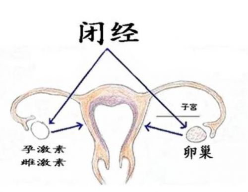 苏州治疗绝经医院