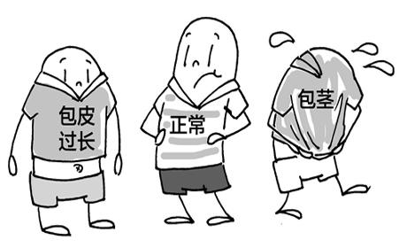 苏州包皮手术哪家医院好